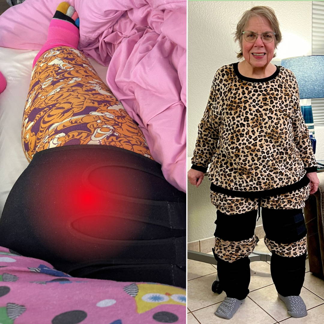 Beltwell® The Adjustable Thigh Lymphedema Compression Wraps For Big